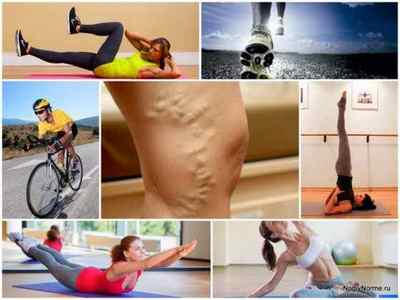 Чи можна займатися спортом при варикозі вен на ногах - рекомендовані і протипоказані навантаження
