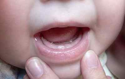 Чи можуть бути соплі при прорізуванні зубів у дітей, як їх лікувати