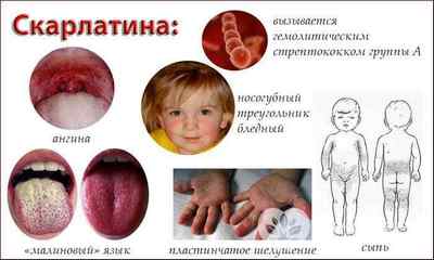 Чим лікувати червоне горло у дитини - ефективні засоби