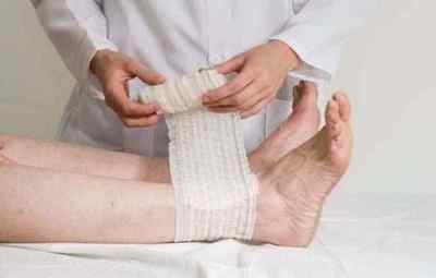 Чим лікувати трофічну виразку на нозі при варикозі
