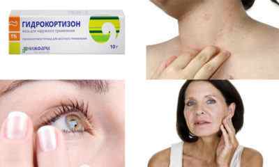 Чим може допомогти мазь гідрокортизону при зморшках на обличчі і шкірі навколо очей: інструкція із застосування