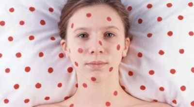 Чим може допомогти мазь гідрокортизону при зморшках на обличчі і шкірі навколо очей: інструкція із застосування