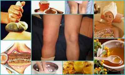 Чим і як лікувати артрит колінного суглоба в домашніх умовах?