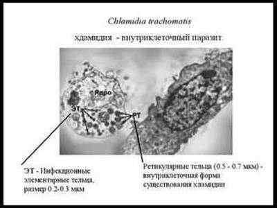 Chlamydia trachomatis: симптоми, лікування, діагностика