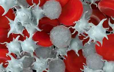 Чому підвищуються лейкоцити в крові