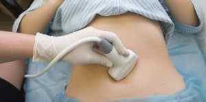 Діагностика раку шийки матки: як визначити захворювання