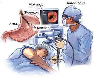 Діагностика виразки шлунка: основні лабораторні та інструментальні методи