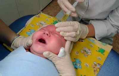 Дакріоцистит у новонароджених: лікування, симптоми у дітей до року, відгуки, чим небезпечний