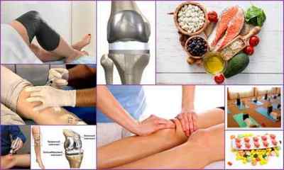 Деформуючий артроз колінного суглоба 12 3 ступеня: лікування, симптоми і ознаки