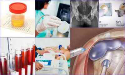 Деформуючий остеоартроз 12 3 ступеня: діагностика, лікування, профілактика