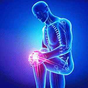 Деформуючий остеоартроз (ДОА) колінних суглобів 12 і 3 ступеня: що це таке, симптоми і лікування народними засобами, діагноз | Ревматолог