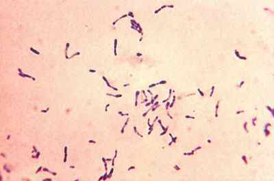 Дифтерія: патогенез, клініка, етіологія і епідеміологія