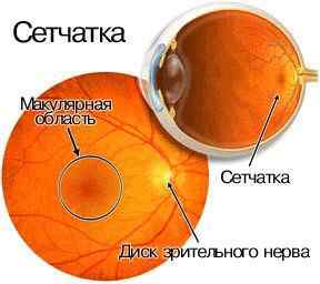 Дистрофія сітківки ока: що це таке, лікування народними засобами, симптоми атрофії