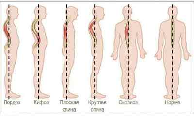 Дошка Євмінова: комплекс вправ для витягування хребта на похилій дошці | Ревматолог