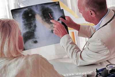 Доза опромінення при флюорографії і рентгені легких