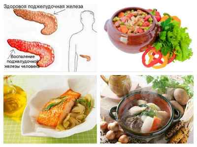 Дієта при гострому панкреатиті: харчування при загостренні в підшлунковій залозі, меню