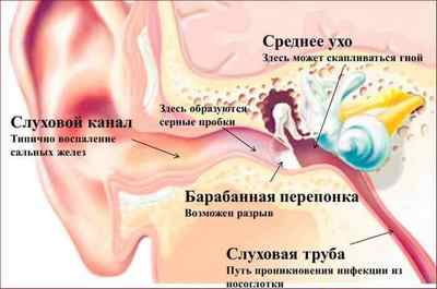 Дзвін у вухах: причини і лікування перевіреними методами
