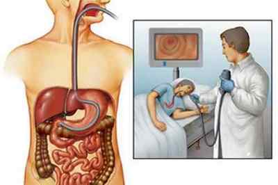 Ендоскопія кишечника: поняття, види, підготовка та проведення