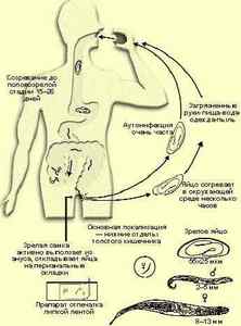 Ентеробіоз: доктор Комаровський розповідає як лікувати небезпечних глистів і вести профілактику від гостриків