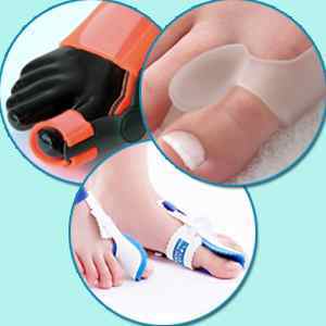 Фіксатори кісточки для великого пальця ноги: відгуки, накладки і нічні коригуючі бандажі | Ревматолог