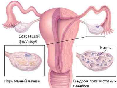 ФСГ у жінок і чоловіків: що таке фолікулостимулюючий гормон?