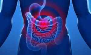 Гази в шлунку: причини і лікування, чому накопичується повітря в кишечнику