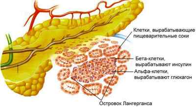 Геморагічний панкреонекроз (панкреатит), гостра і тотальна форми