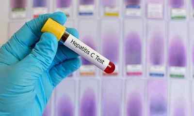 Генотипування гепатиту С або як визначити генотип