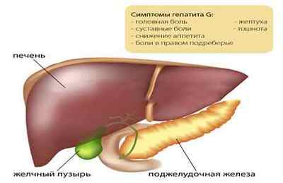 Гепатит G: симптоми, шляхи зараження та лікування