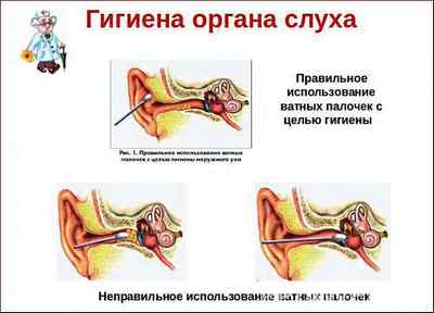 Гігієна вух: основні правила та рекомендації фахівців
