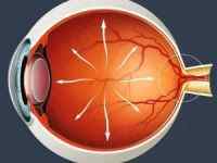 Глаукома: що це таке, причини, симптоми, лікування і профілактика