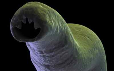 Глисти під мікроскопом: як виглядають збільшені паразити, личинки і яйця глистів, фото