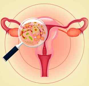 Глисти у піхву: чи можуть бути вагінальні паразити в матці дівчинки, симптоми і фото