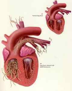 Глисти у серце: паразити і черви в серці у людини, симптоми