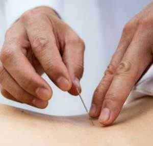 Голковколювання при грижі хребта: лікування шийного та поперекового відділів, чи допомагає | Ревматолог