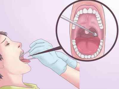 Гонорея горла: причини, симптоми, лікування і діагностика
