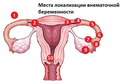 Гонорея у жінок: причини, симптоми, лікування і діагностика