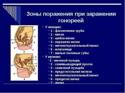 Гонорейний уретрит: симптоми, діагностика та лікування