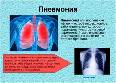 Гостра пневмонія: клініка, діагностика і лікування