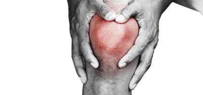 Гострий артрит: симптоми і лікування, як зняти запалення суглобів, як зняти біль при артриті в період загострення | Ревматолог
