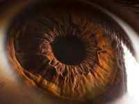 Гіпертонічна ангіопатія сітківки обох очей: лікування, причини