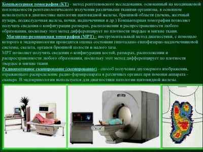 Гіпофункція щитовидної залози: що це таке, симптоми і лікування