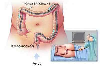 Гістологія тонкого і товстого кишечника: підготовка і проведення