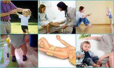 Х-образні ноги у дитини - лікування викривлення