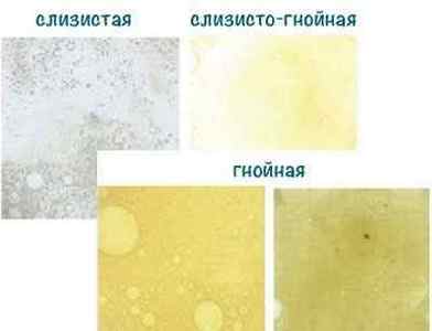 Характер і колір мокротиння при бронхіті
