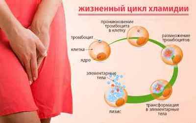 Хламідіоз при вагітності: причини, лікування, симптоми