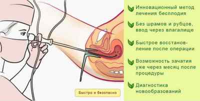 Хронічний ендометріоз: що це таке, симптоми і лікування