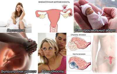 Хронічний вагініт: причини, симптоми, лікування