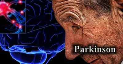Хвороба Паркінсона та тривалість життя в останній стадії