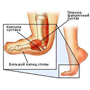 Хвороби ніг у людей і їх лікування: причини у жінок, медицина | Ревматолог